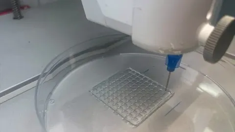 3 boyutlu biyoyazıcıyla "melanom" tedavisine yönelik "mikroiğne yaması" geliştirildi