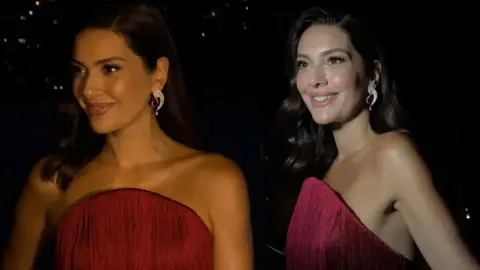 Fazla kilolarından eser kalmadı! Bergüzar Korel’in son hali dikkat çekti