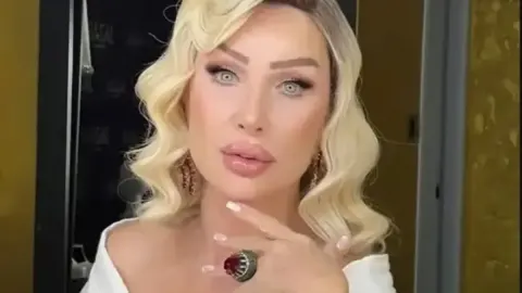 Seda Sayan’dan estetik çıkış: Biyolojik yaşımı göstermemek için uğraşıyorum